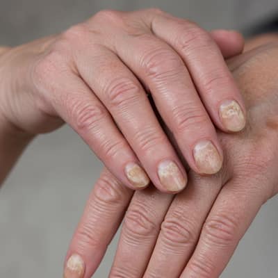 Mãos e unhas